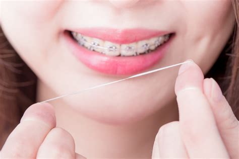 How to Floss With Braces: 5 Helpful Tips - Yba City Orthodontics