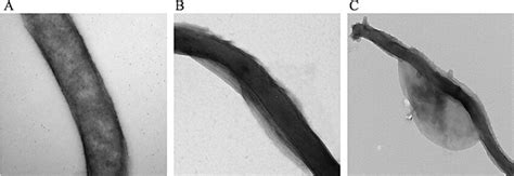 Treatment of B. burgdorferi cells with lipoxidase causes membrane ...