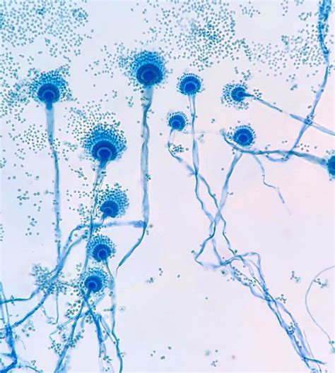 Aspergillus fumigatus stained with Lactophenol Cotton Blue. | Imagenes ...