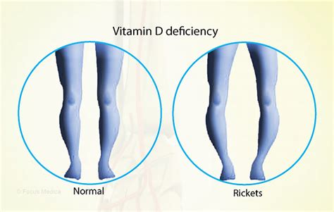 Health Condition : Symptoms, Causes, Treatment and More