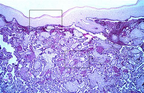 HLS [ Female Reproductive System, placenta, fetal side] MED MAG