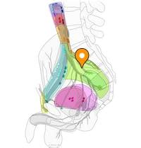 Internal iliac nodes - e-Anatomy - IMAIOS