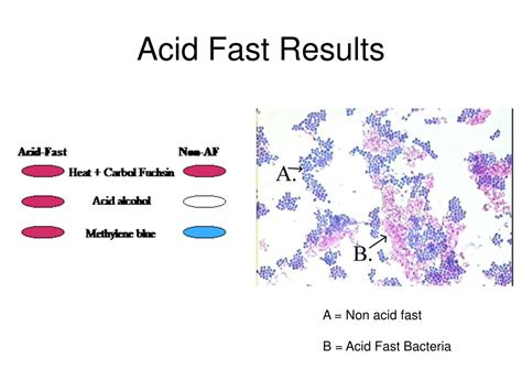 PPT - Bacterial Staining PowerPoint Presentation, free download - ID:1114051