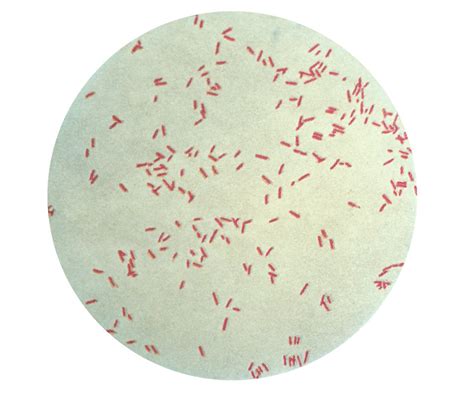 Public Domain Picture | A photomicrograph of Pseudomonas aeruginosa, also known as Bacillus ...