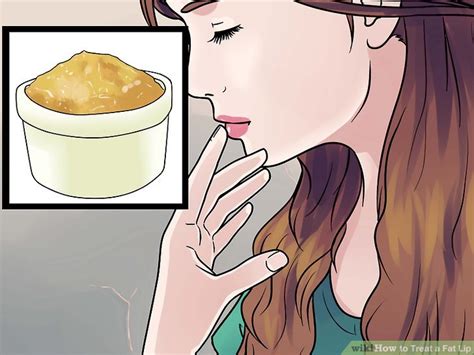 How to Treat a Fat Lip: 14 Steps (with Pictures) - wikiHow