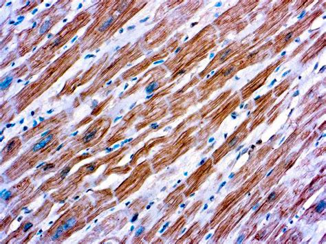 Alpha Actinin - Mob227 - Diagnostic BioSystems(dbiosys) DBS