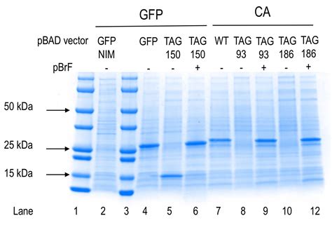 Methods for SDS-PAGE – Chemical Biology & Biochemistry Laboratory Using Genetic Code Expansion ...