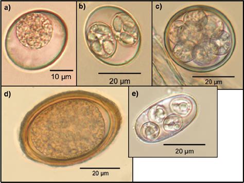 Coccidia oocysts: Cystoisospora species (a, b), coccidia oocyst with... | Download Scientific ...