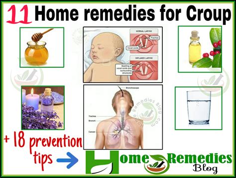 11 Home Remedies For Croup Treatment & Prevention Tips - Home Remedies Blog