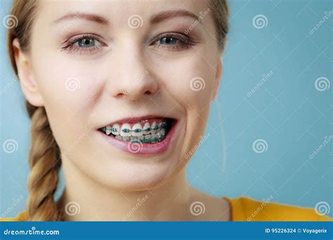 Funny Expression With Braces Stock Photo | CartoonDealer.com #25153824