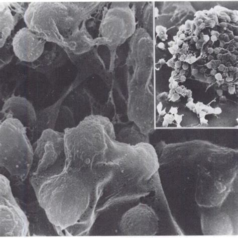 Cumulus oophorus incubated with 0.2 mM MIX for 24 h. Amorphous material... | Download Scientific ...