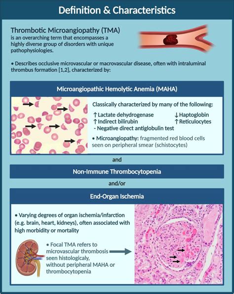 😱Challenges in medicine😱 Thrombotic microangiopathy (TMA) A short 🧵#MedTwitter 1/16 - Thread ...