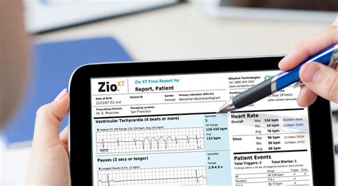 The Zio by iRhythm Patient Report. Comprehensive. Intuitive. Accurate.