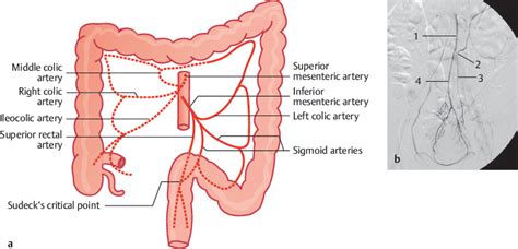 Inferior Mesenteric Artery | Radiology Key