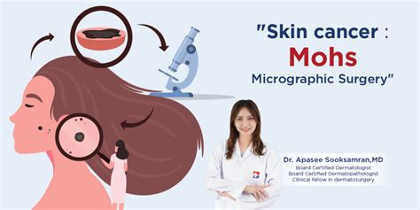 “Skin cancer : Mohs Micrographic Surgery” | Bangkok Hospital Phuket ...