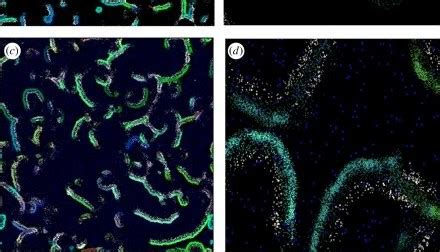 How restriction of gene flow accelerates speciation?