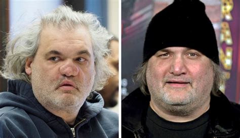 Artie Lange: ‘My nose looks like it got hit with 32 years of gambling ...