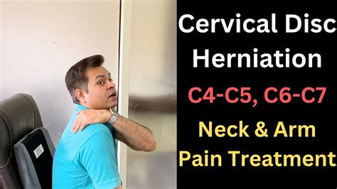 Cervical Disc Herniation, C5-C6, Neck and Arm Pain, Cervical Symptoms ...