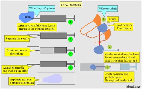 Fine Needle Aspiration Cytology (FNAC) - A Useful Test for Lesion Diagnosis