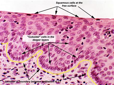 Medical School • Stratified squamous epithelium