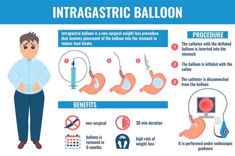 Intragastric Balloon Surgery | Main Line Health