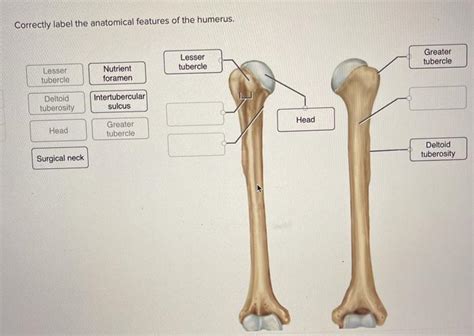 Solved Correctly label the anatomical features of the | Chegg.com