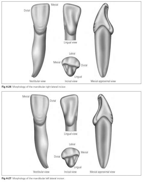 Image result for maxillary lateral incisor drawing Canine Dental, Canine Tooth, Dental Lab ...