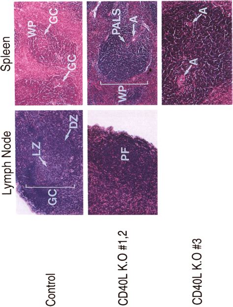 Germinal center formation is not observed in CD40LKO mice after Ag... | Download Scientific Diagram