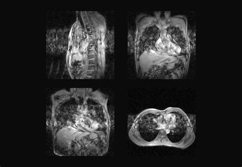 Premium Photo | Dorsal spine mri and ct scan professional xray images