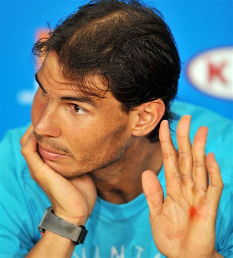 Rafael Nadal treated for nasty blister on hand at Australian Open - Sports Illustrated