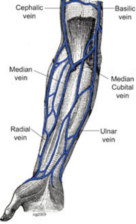 cephalic vein thrombus - ModernHeal.com