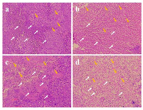 Histological analysis of mouse tumor sections: (a) PBS control group ...