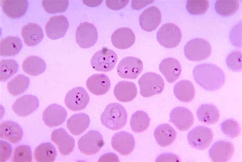 Free picture: photomicrograph, blood smear, plasmodium falciparum, rings, erythrocytes