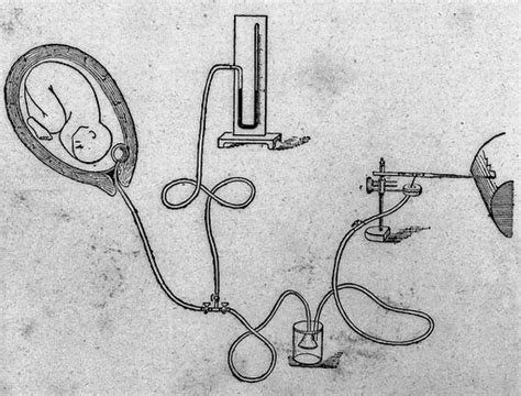 Apparatus: uterine contractions during childbirth free public domain image | Look and Learn