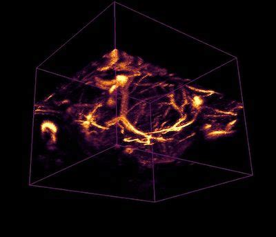 Biomedical Imaging - Joint BME