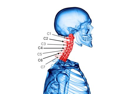 Neck Pain Types and Causes - Spinal Backrack