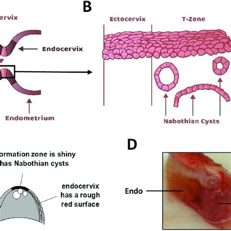 Structure and histology of the cervical TZ. A. Schematic representation ...