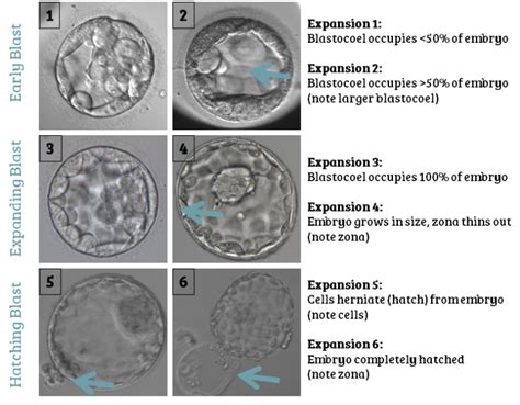 Complete Guide to Embryo Grading and Success Rates | Remembryo