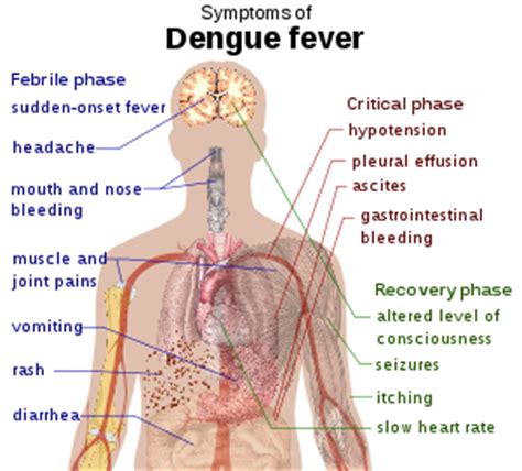 Dengue Hemorrhagic Fever - RNpedia