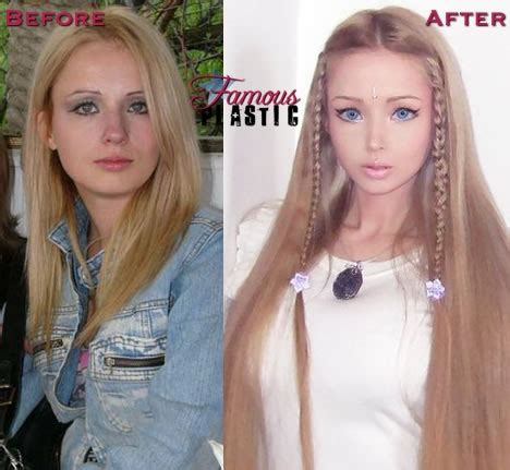 Human Barbie Doll "Valeria Lukyanova" Before And After Plastic Surgery