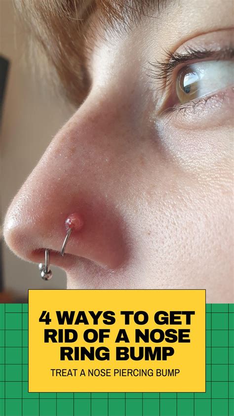 4 Things to Treat Infected Nose Piercing Bump Without Closing It in 2021 | Piercing bump, Nose ...