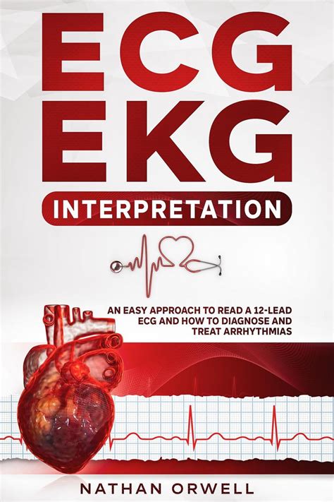 ECG/EKG Interpretation: An Easy Approach to Read a 12-Lead ECG and How ...