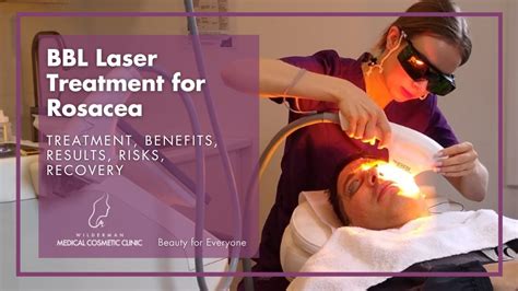 BBL Laser Treatment for Rosacea | Wilderman Cosmetic Clinic | Thornhill