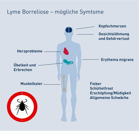 Borreliose Lyme | www.picswe.net