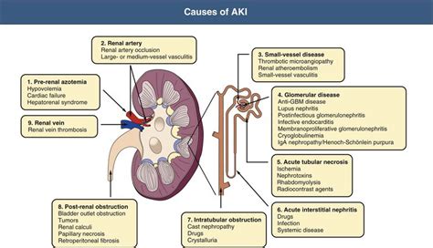 Acute kidney injury,what you need to know?