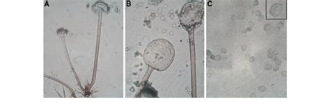 Rhizopus Oligosporus Microscope