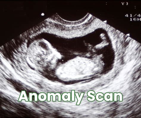 Anomaly Scan Video - Dr. Deepthi Jammi’s explanation