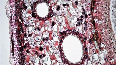 Gymnosperm Stem: Periderm and Cortex in Three Year Pinus | Gymnosperm, Plant cell, Stem