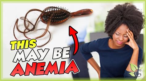 How Anemia causes Hair Loss - The Science behind it - YouTube