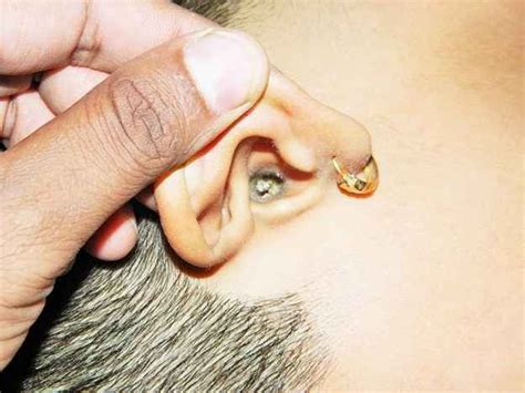 The Gross Earbud Habit You're Probably Guilty Of | Ear wax, Ear, Blackheads